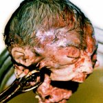 Abortion Doctor Killing Innocent Victim